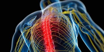 How to identify and treat nerve tension pain